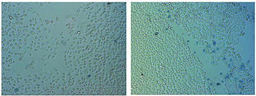 Лечебные катушки treated panc 1 cells.