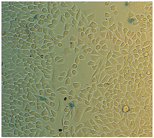 Лечебные катушки 6 Magnification x200.