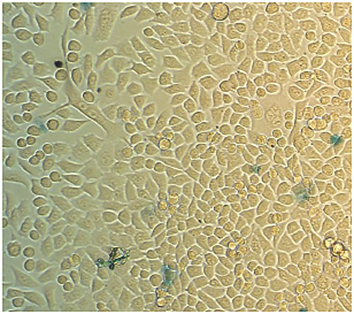 Лечебные катушки 6a Magnification x200.