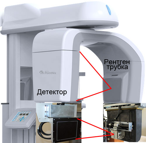 Конусно лучевой томограф - получение 3D изображения.
